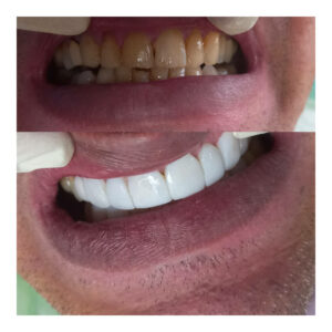 InShot_20230821_162356621