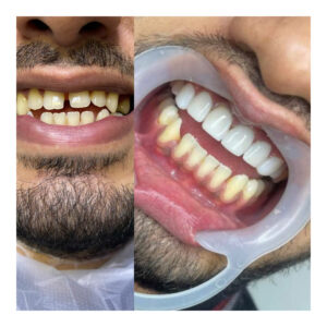 InShot_20230821_164121011