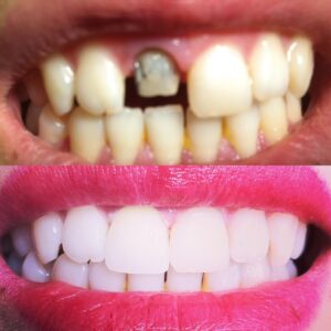 تاپ استایل دندانپزشکی