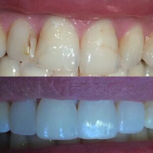 لمینت تاپ استایل