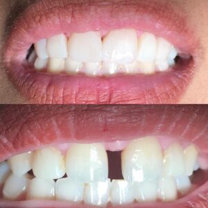 لمینت تاپ استایل